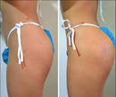 PEPTONAS BRASILEÑAS PARA GLUTEOS  - Crecimiento Muscular Local - ideal para glúteos, piernas, hombro y pecho DESCER